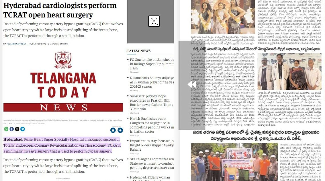 Telangana Today — Hyderabad cardiologists perform TCRAT open heart surgery